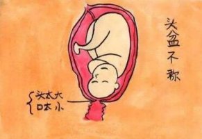 頭盆不稱(chēng)是什么意思