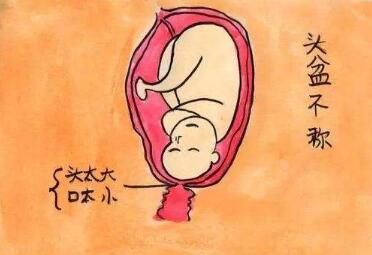 頭盆不稱是什么意思