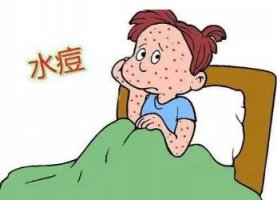 水痘的傳染期是多少天