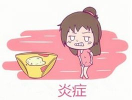 婦科炎癥有哪些癥狀