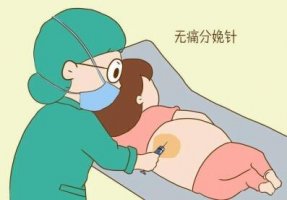 無痛分娩有幾種方式
