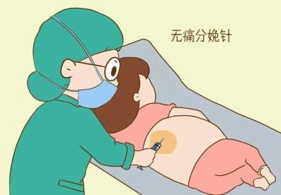無痛分娩有幾種方式