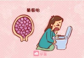 葡萄胎早期癥狀有哪些