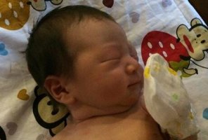 新生兒病理性黃疸癥狀