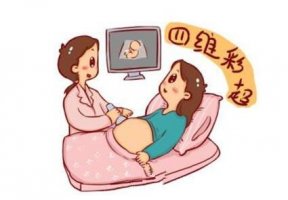 四維彩超什么時(shí)候做的最佳時(shí)間