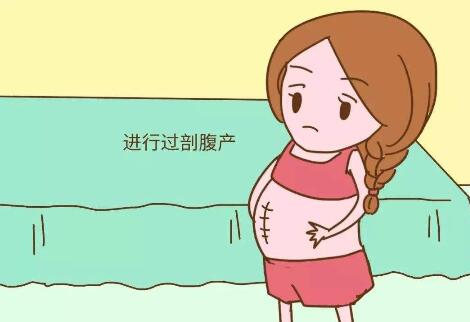 剖腹產(chǎn)疤痕增生多久可以知道