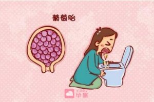 為什么會(huì)出現(xiàn)葡萄胎的原因