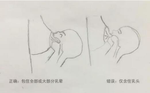 有一種痛，叫產(chǎn)后漲奶