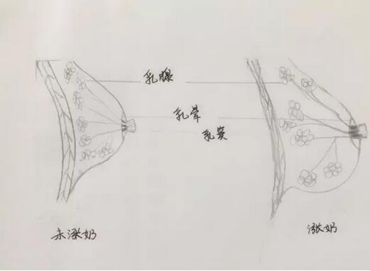 有一種痛，叫產(chǎn)后漲奶