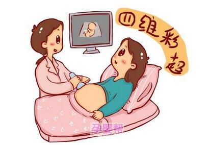 四維彩超怎么看男女