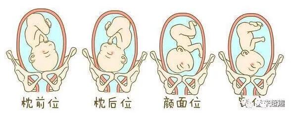 胎位不正，看這篇就夠了