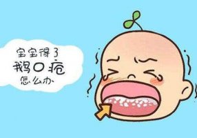 嬰兒鵝口瘡圖片