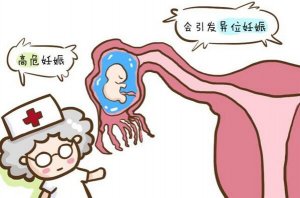 高危妊娠究竟有多危險(xiǎn)