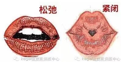 產(chǎn)后恢復(fù)，修復(fù)陰道松弛