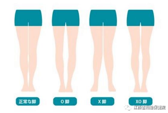 給嬰兒綁腿科學(xué)嗎