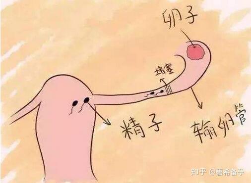 輸卵管造影是什么