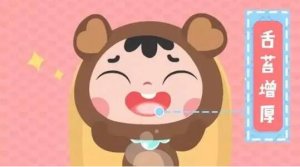 嬰兒舌苔厚白是怎么回事