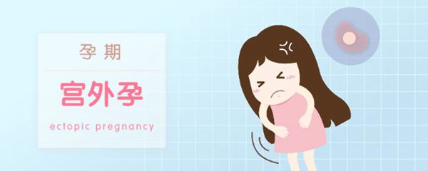 懷孕了，如何自我排除宮外孕？