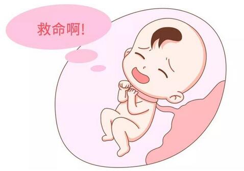 新生兒窒息