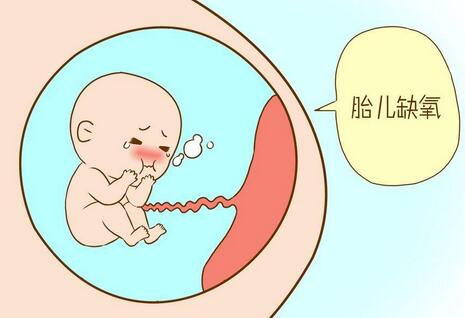 新生兒窒息