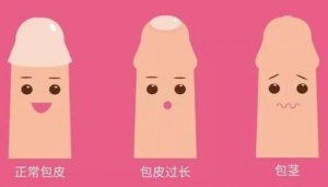 割包好處和壞處
