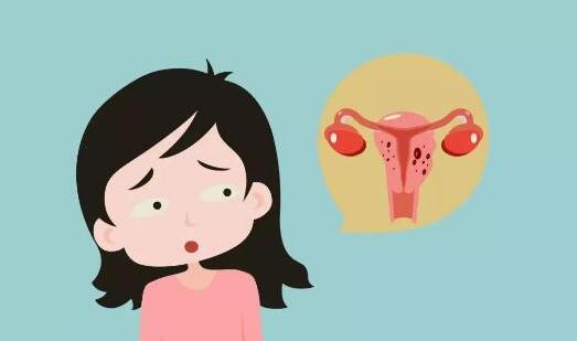 子宮腺肌癥能懷孕嗎
