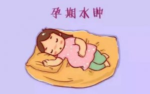 孕婦水腫的原因