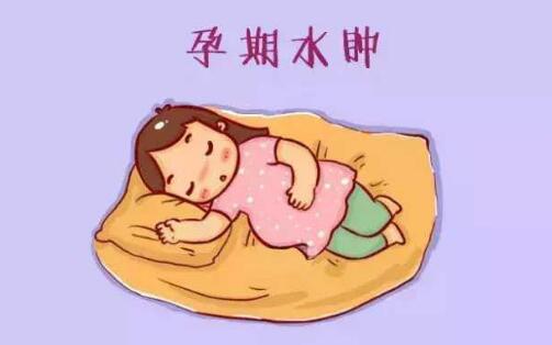 孕婦水腫的原因