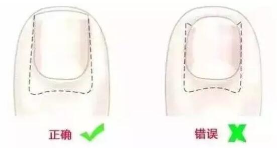 給寶寶剪指甲該怎么剪