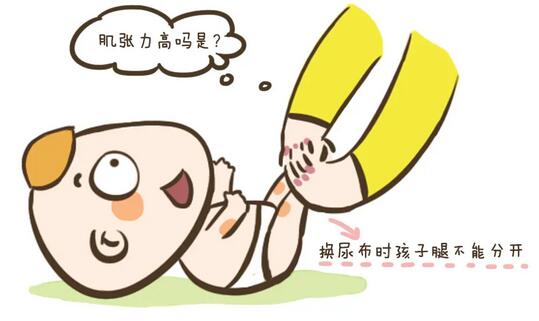 肌張力高的常見誤區(qū)有哪些