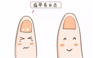 寶寶指甲上有白點(diǎn)是怎么回事