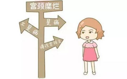 宮頸糜爛根本不是病