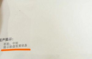 孕媽胎盤低置注意事項(xiàng)