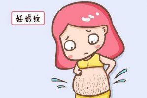 妊娠紋怎么消除