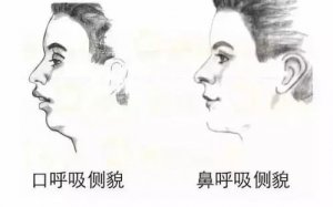 寶寶口呼吸的危害有哪些