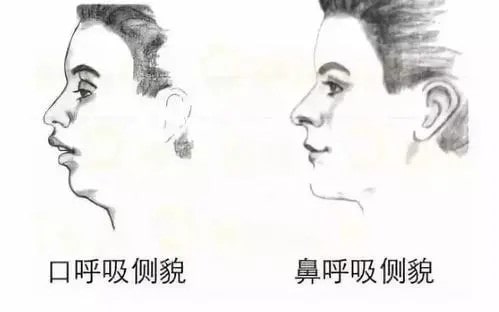 寶寶口呼吸的危害有哪些