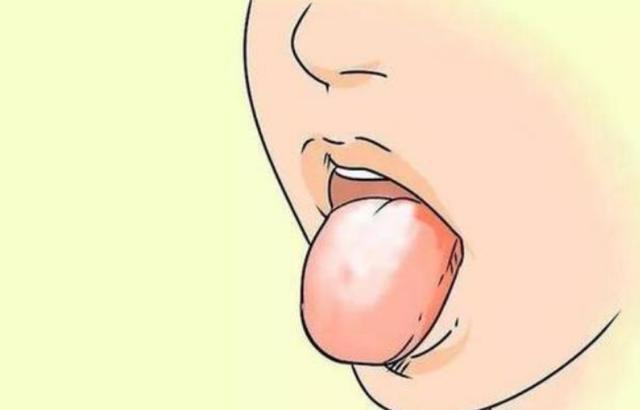 舌苔發(fā)白是什么原因呢