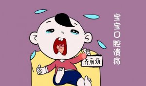 寶寶口腔潰瘍是什么原因造成