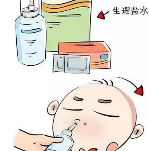 新生兒鼻塞怎么辦