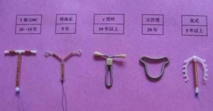 產(chǎn)后避孕，上環(huán)好不好？