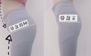 怎么判斷自己產(chǎn)后需不需要進(jìn)行骨盆修復(fù)？