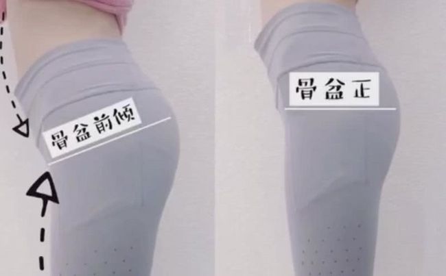 怎么判斷自己產(chǎn)后需不需要進行骨盆修復(fù)？