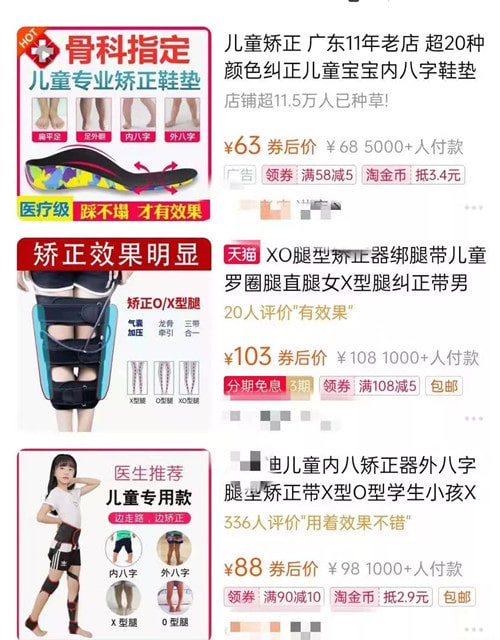 寶寶腿不直怎么辦 x型腿怎么矯正