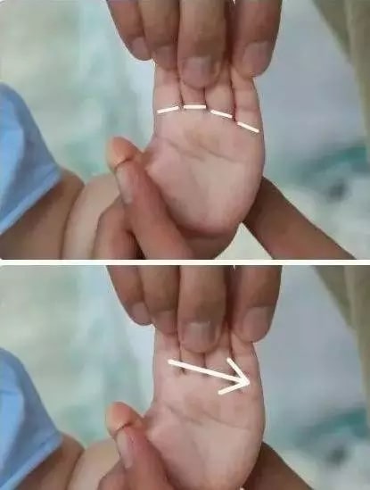 實用的小兒推拿方法圖文教程