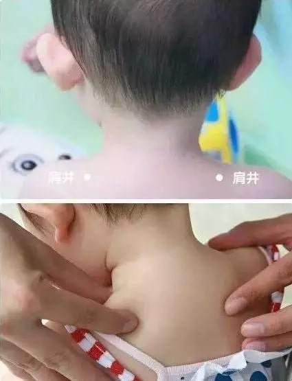 實用的小兒推拿方法圖文教程