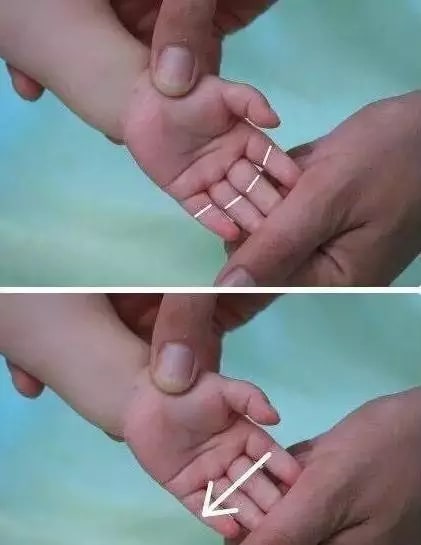 實用的小兒推拿方法圖文教程