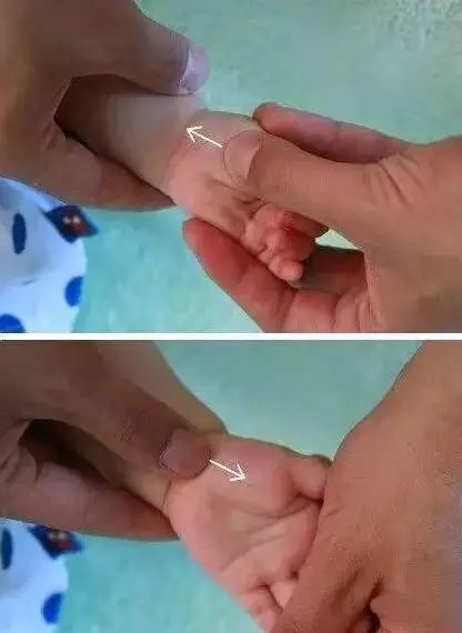 實用的小兒推拿方法圖文教程