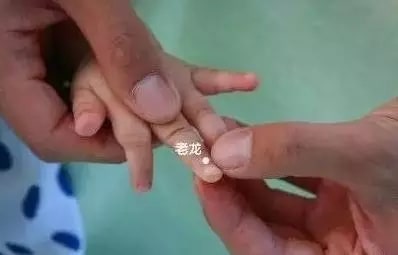 實用的小兒推拿方法圖文教程