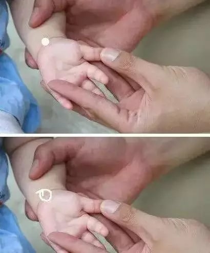 實用的小兒推拿方法圖文教程