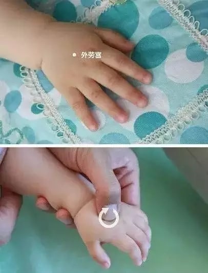 實用的小兒推拿方法圖文教程